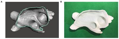 Improving Left Atrial Appendage Occlusion Device Size Determination by Three-Dimensional Printing-Based Preprocedural Simulation
